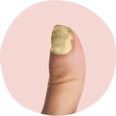 الأظافر-الصفراء-أكثر-من-مجرد-عدوى-فطرية