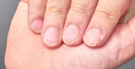 3-خطوات-لإصلاح-وتقوية-الأظافر-المتضرّرة-في-المنزل